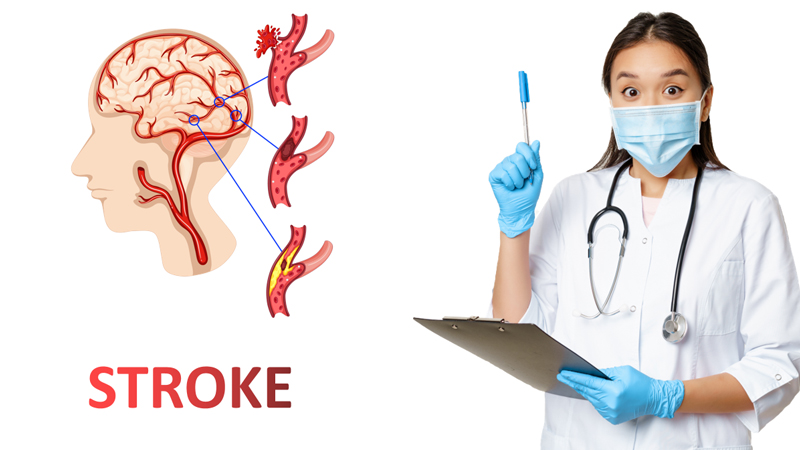 Penyakit Stroke, Tanda-tanda Awal yang Tidak Boleh Diabaikan – PAFI Kota Raha